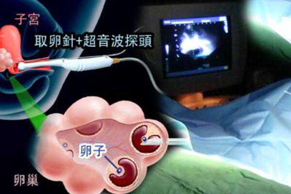 排名前十的深圳试管助孕机构,哪些机构发布了深圳十大试管婴儿医院排名榜名