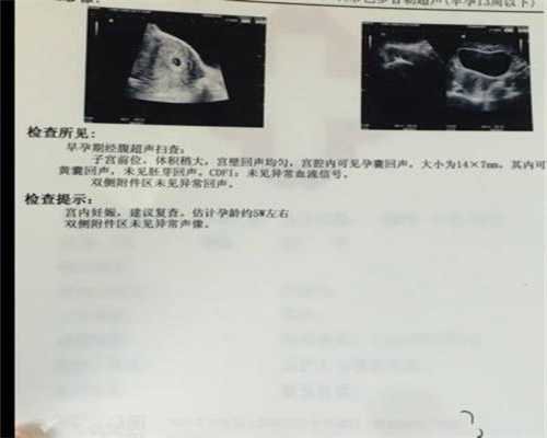 中国有合法的人工待孕_早孕反应怎么办恰当饮食