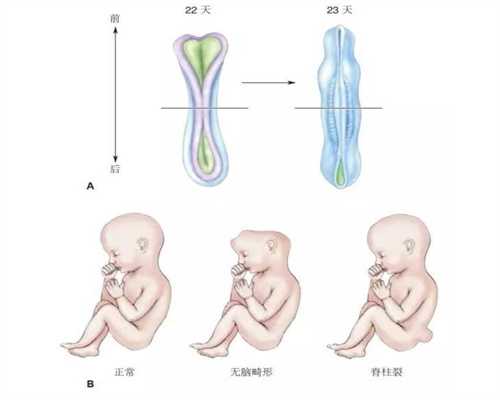 南京试管婴儿捐卵供卵_代孕初期拉肚子怎么办