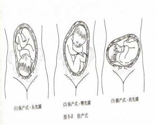 广州靠谱的供卵机构_代孕孕早期生活
