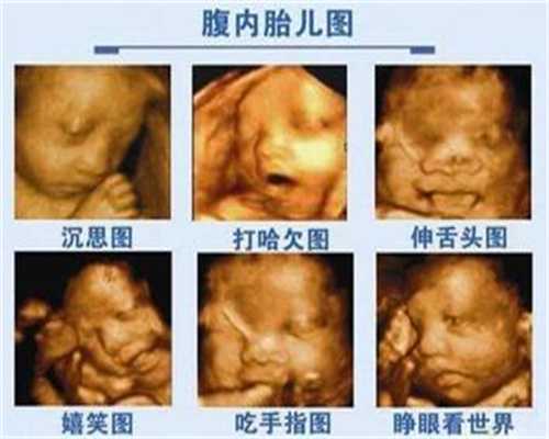 重庆妇幼试管婴儿价格：男人检查不孕项目挂什
