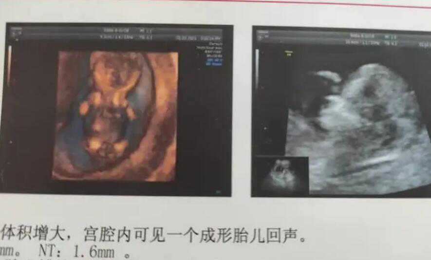 深圳做供卵试管法律允许吗 试管婴儿深圳北大医院在哪里关于试管婴儿要知道